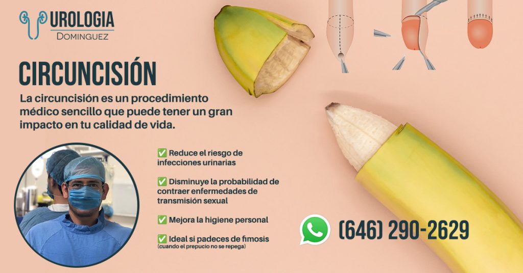 Circuncisión en Ensenada con el Dr. Fernando Domínguez